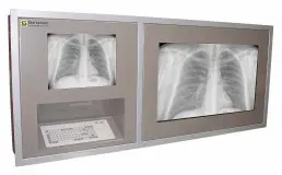 Bespoke Solution